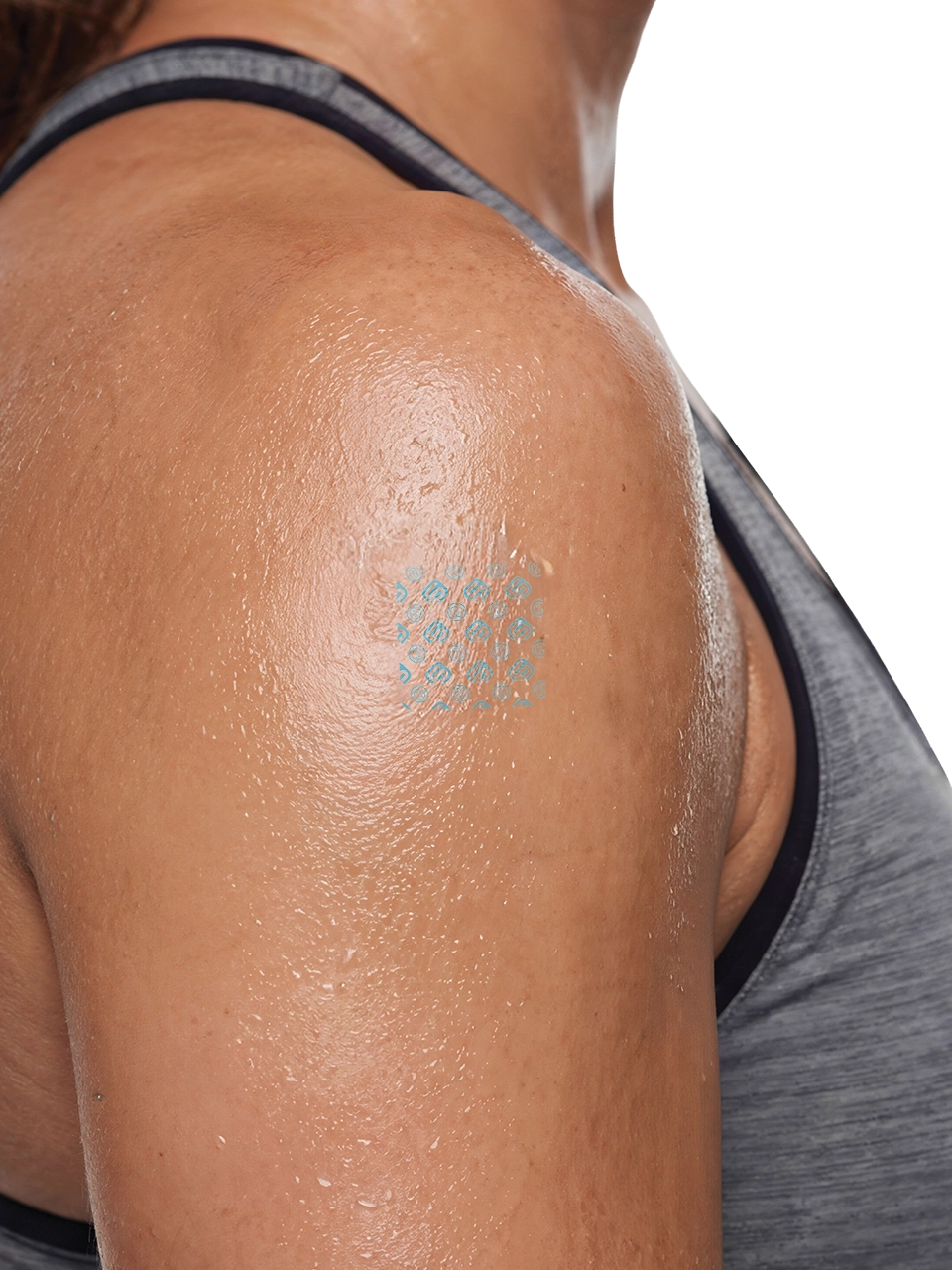 Super Patch applied to the shoulder