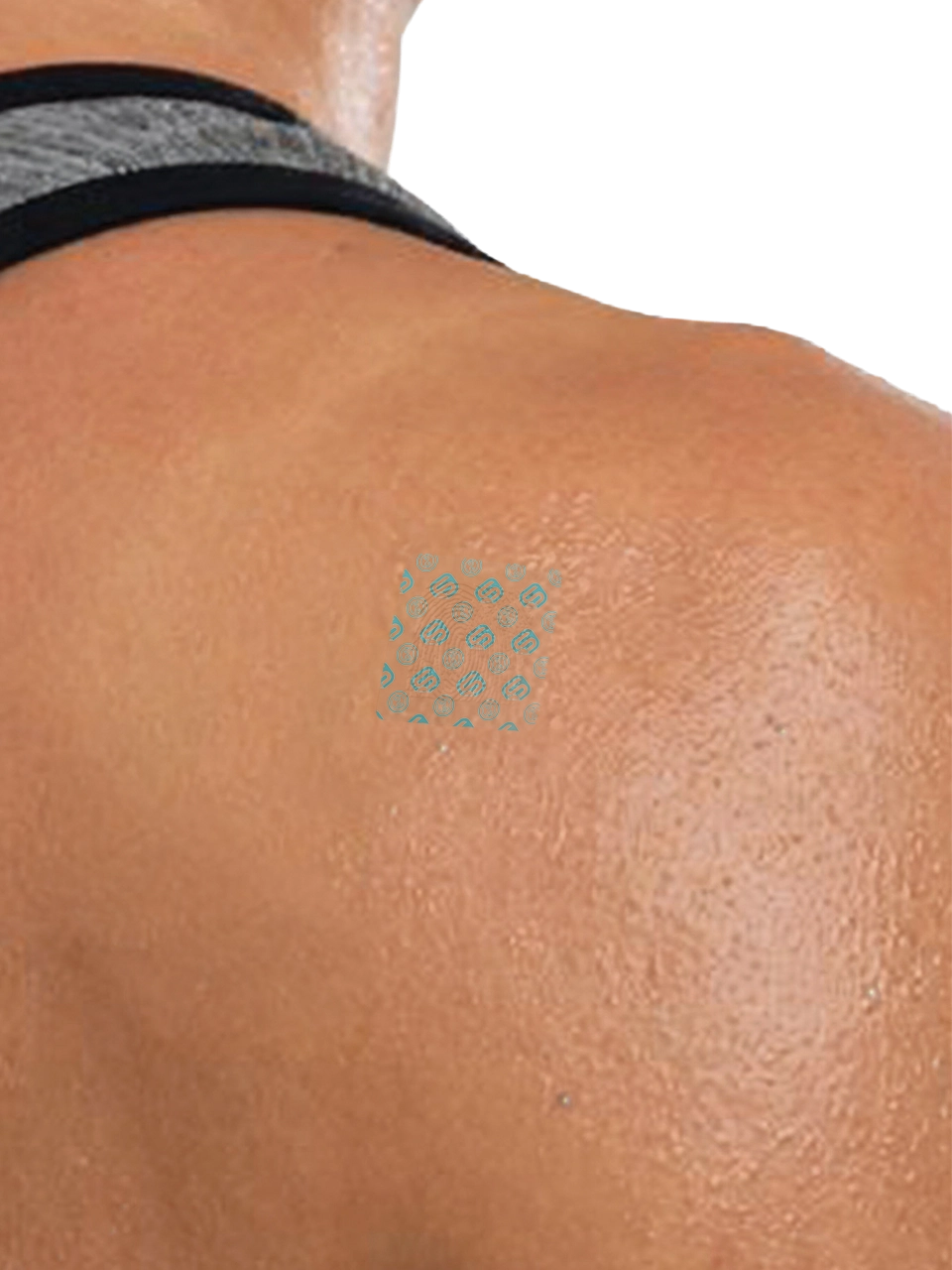 Super Patch applied to the upper back
